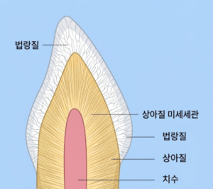 앞니 깨짐