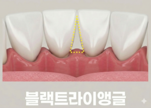 블랙트라이앵글