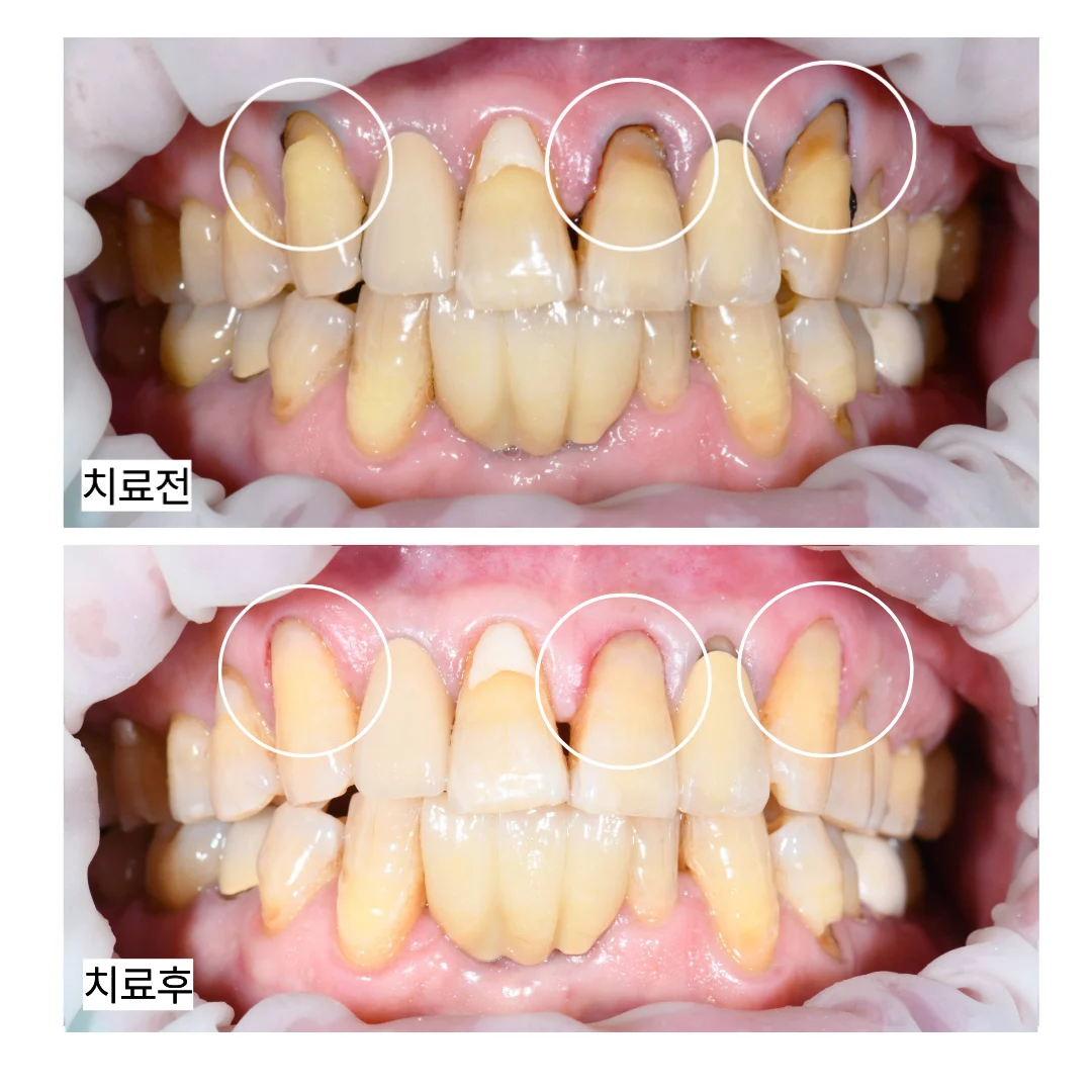 치료 전 임상 기록