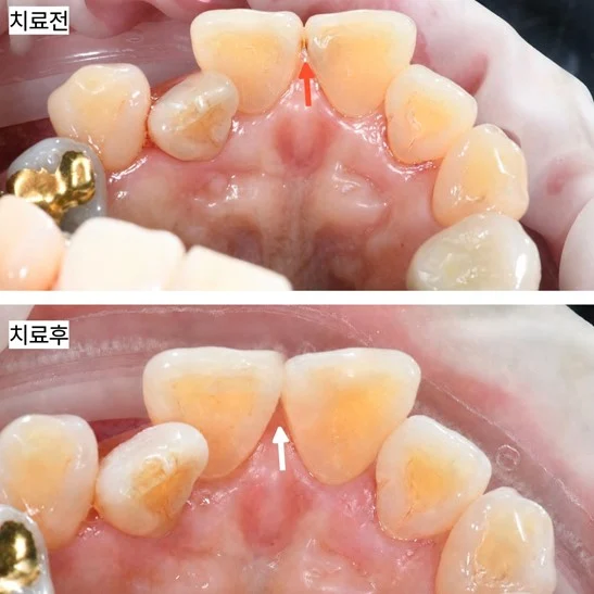 치료 전 임상 기록