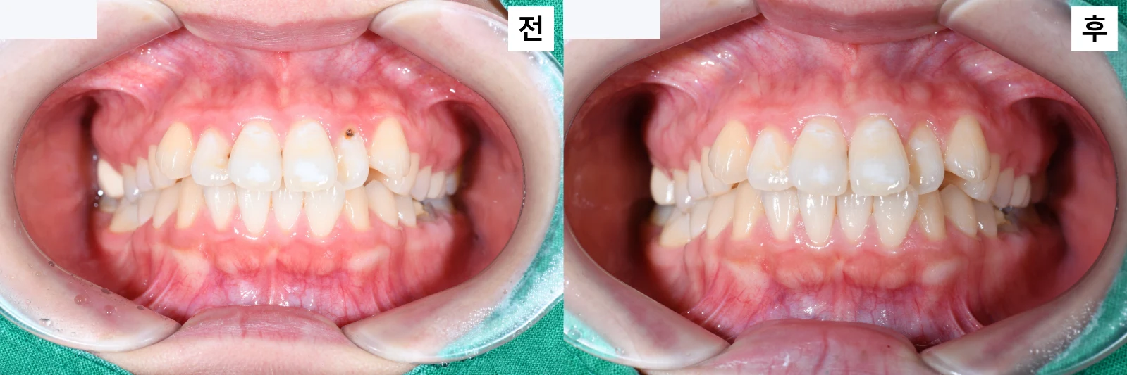 치료 전 임상 기록