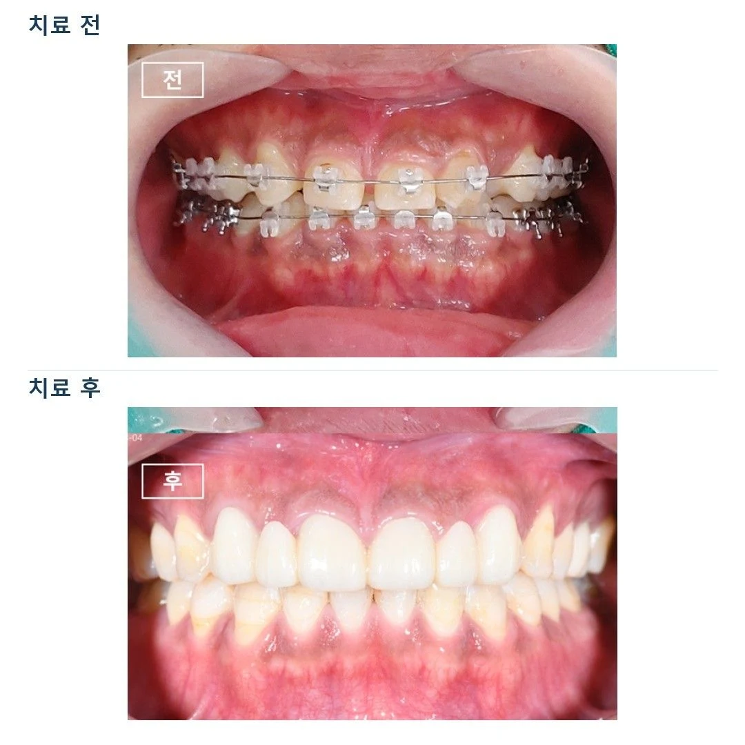 치료 전 임상 기록