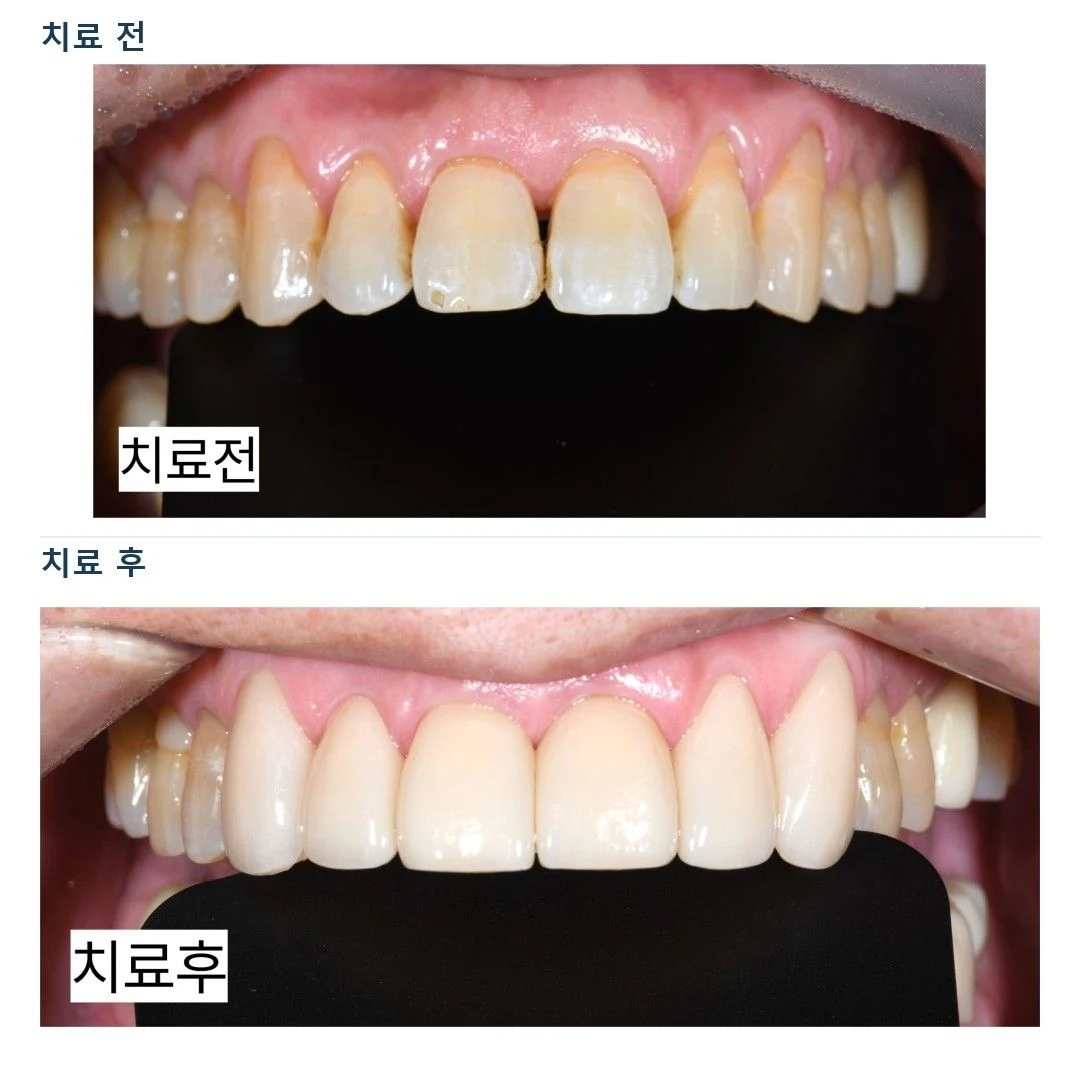치료 전 임상 기록