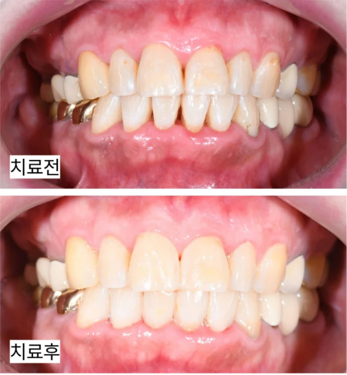 치료 전 임상 기록