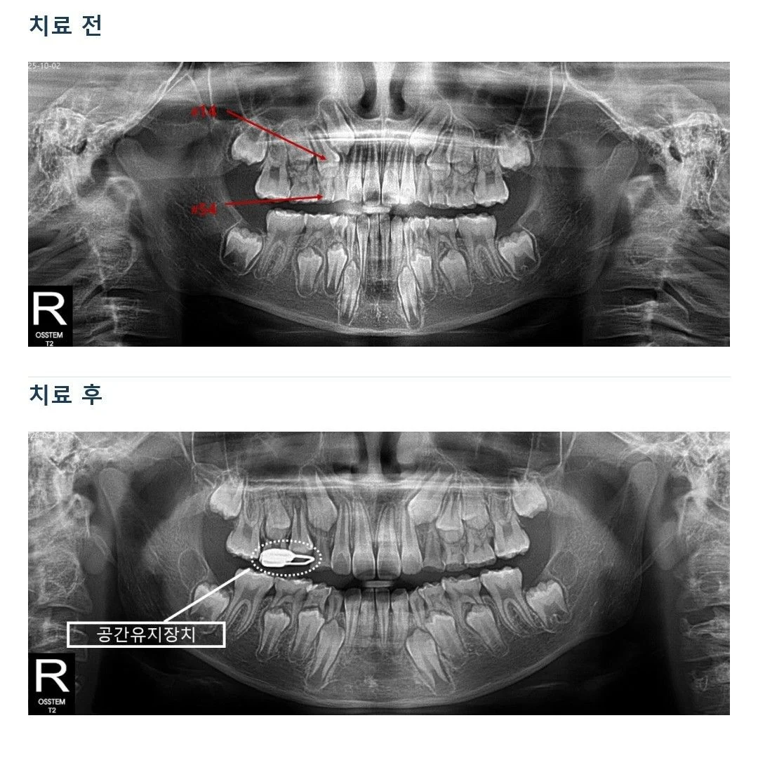 치료 전 임상 기록