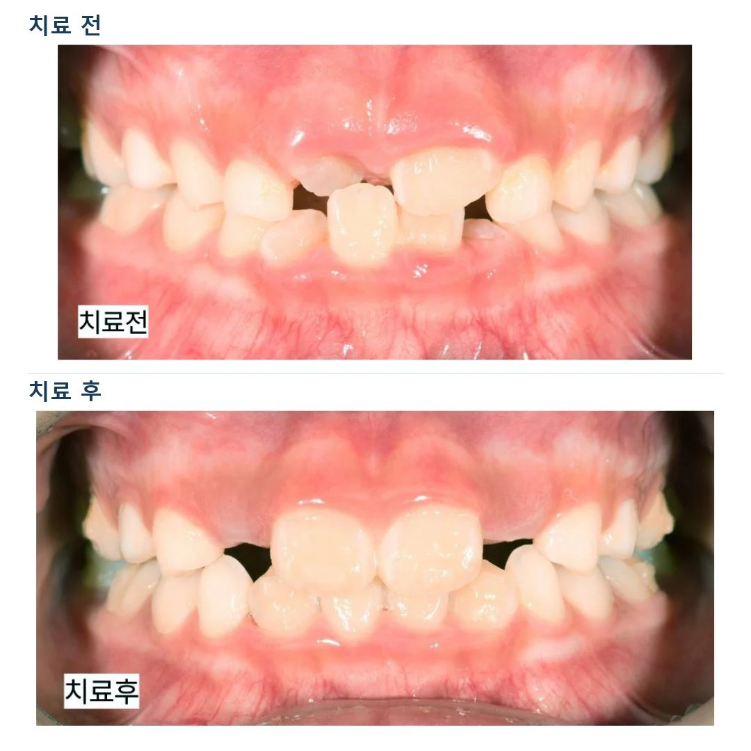 치료 전 임상 기록