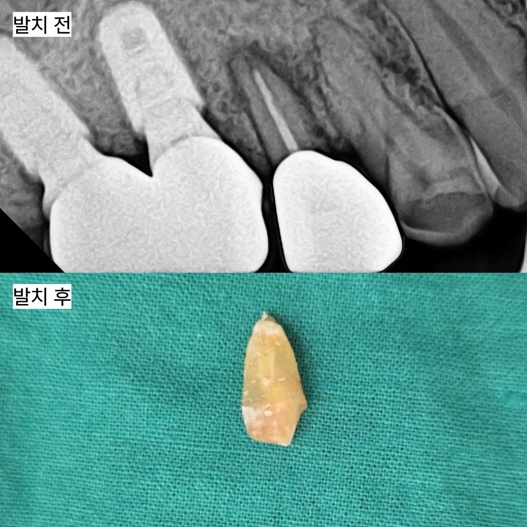 치료 후 임상 기록