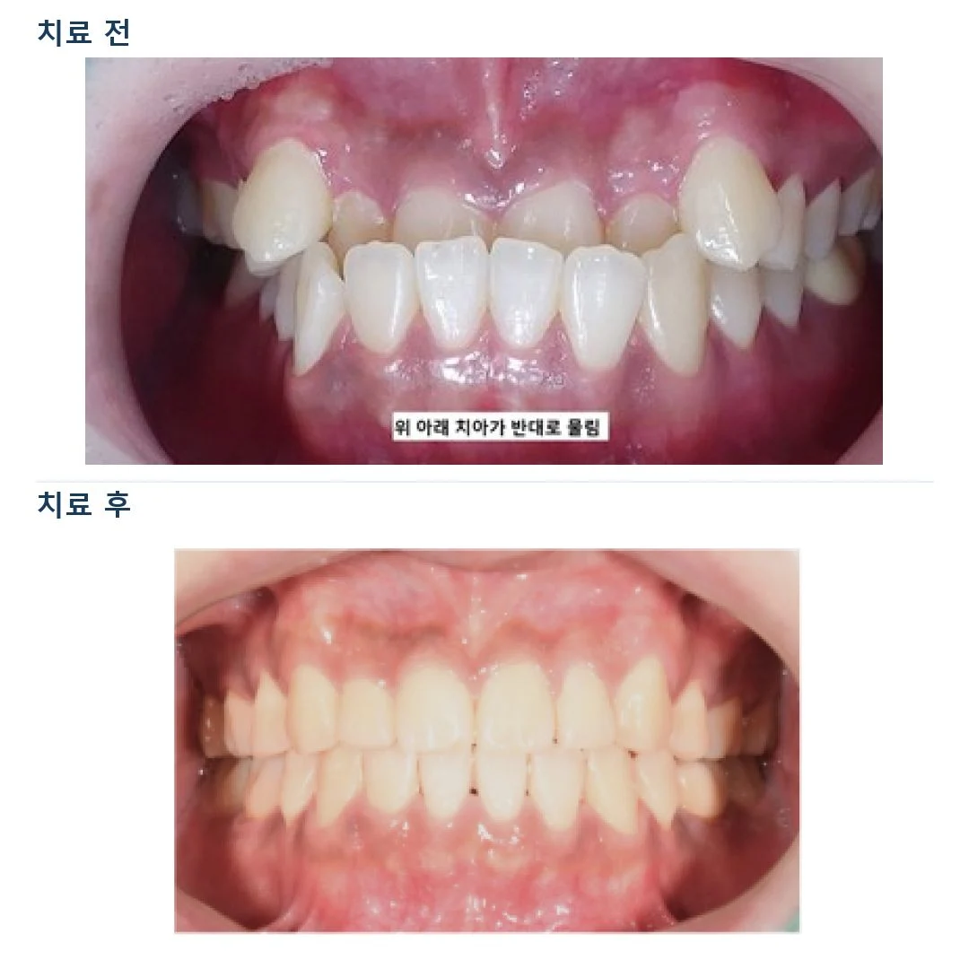 치료 전 임상 기록