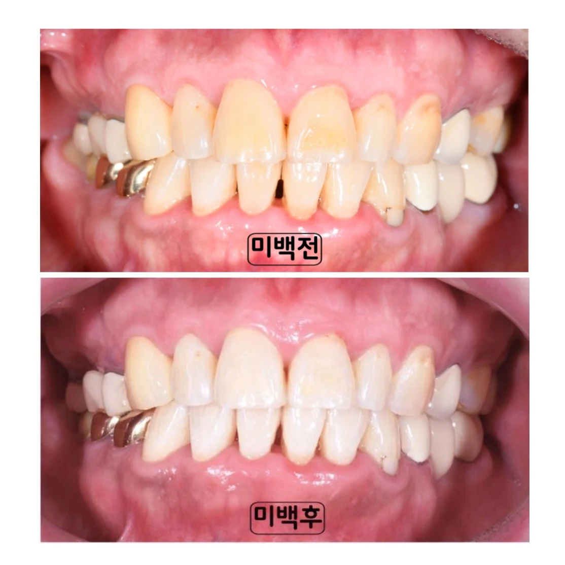 치료 전 임상 기록