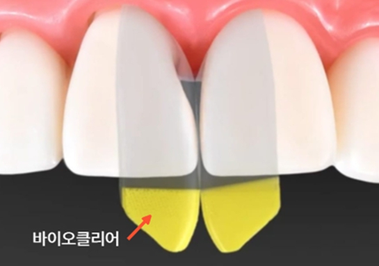 투명 매트릭스를 설명하는 AI 일러스트