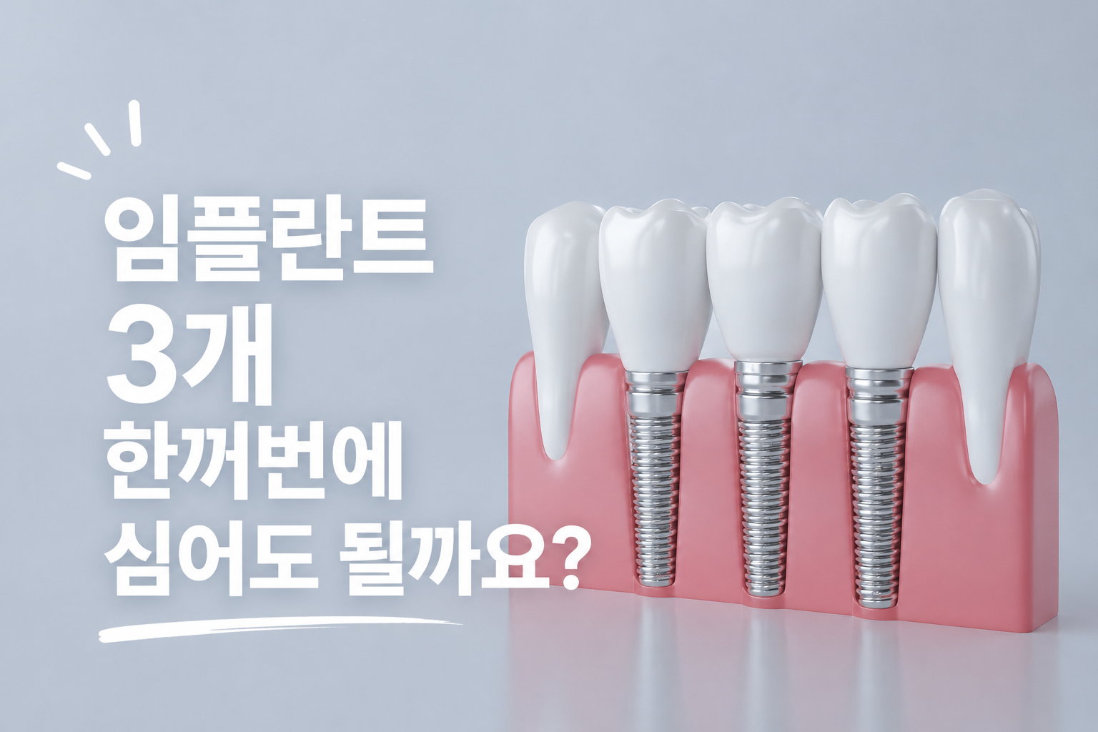 임플란트 3개 한꺼번에 심어도 될까요 꼭 알아야 할 기준