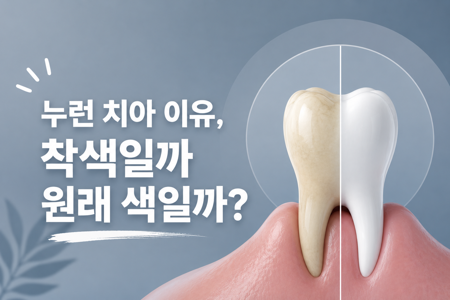 누런 치아 이유, 착색일까 원래 색일까?