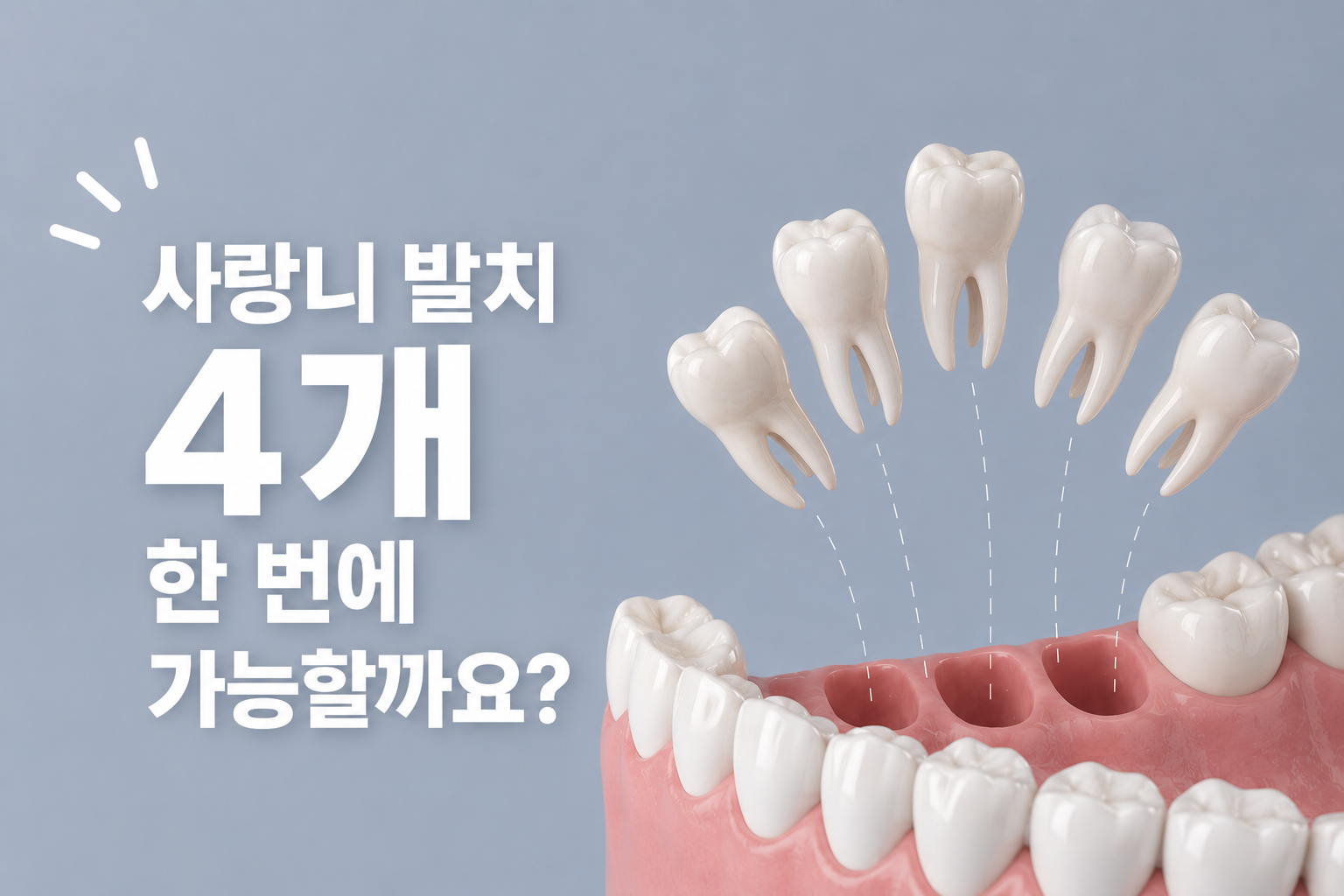 사랑니 발치 4개 한 번에 가능할까요? 통증과 회복 기준 정리