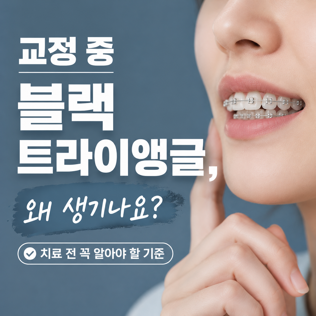 교정 중 블랙트라이앵글, 왜 생기나요? 치료 전 꼭 알아야 할 기준
