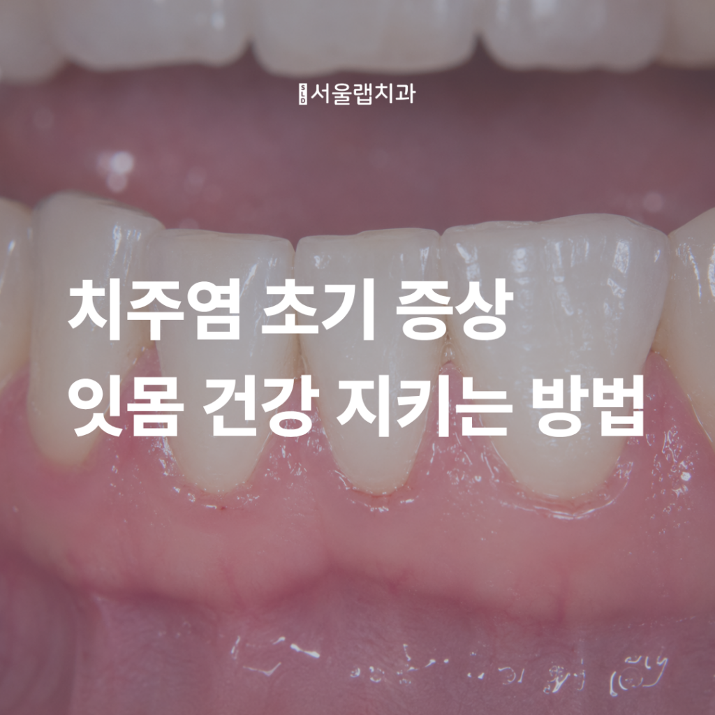 치주염 초기 증상과 치료법, 잇몸 건강 지키는 방법