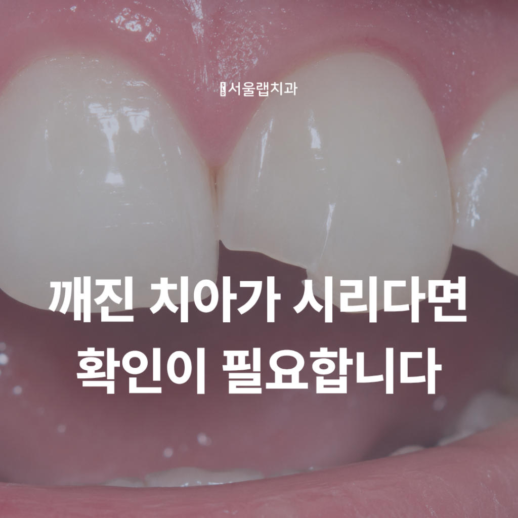 치아깨짐 시림, 금이 간 치아일까요? 치료 전 확인해야 할 신호