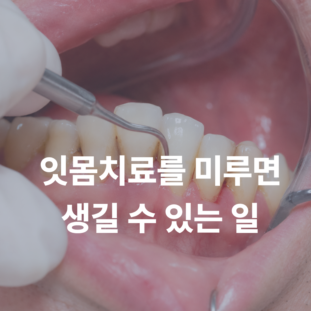 잇몸치료를 미루다 치아를 잃을 뻔했던 환자 이야기, 발치 전 반드시 확인할 신호