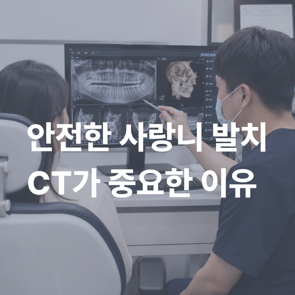 안전한 사랑니 발치를 위한 CT 촬영의 필요성  가능동치과