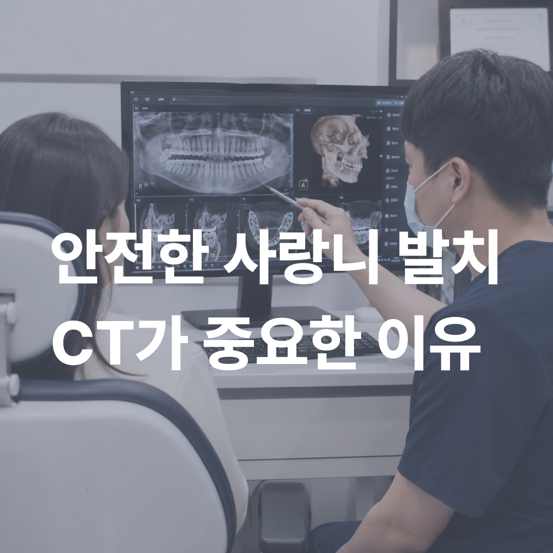 안전한 사랑니 발치를 위한 CT 촬영의 필요성  가능동치과