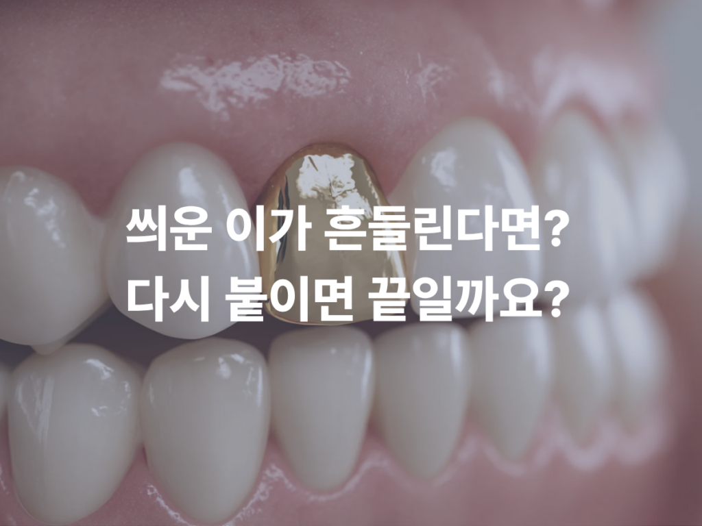 씌운 이가 흔들리면 다시 붙이면 될까요? 크라운 안쪽을 봐야 하는 이유 의정부동치과